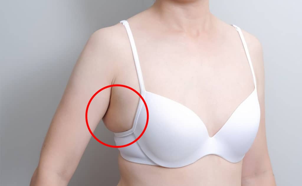 How To Get Rid Of Side Boob Fat? 3 Things You Can Do